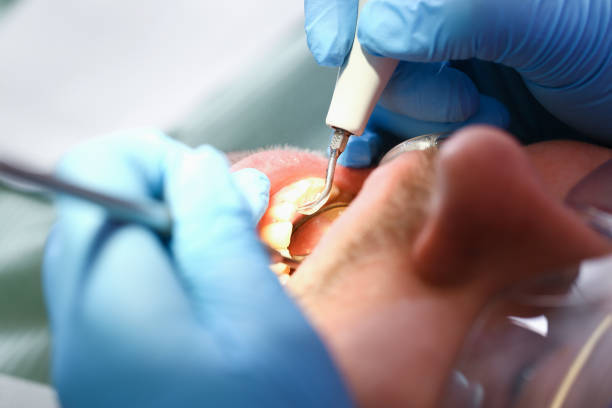 Best Mobile Emergency Dentist in Mpbell, CA