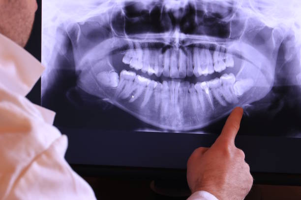 Best Holiday Emergency Dentist in Mpbell, CA