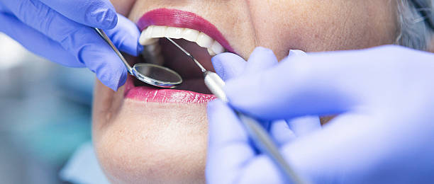 Best Emergency Dentist for Special Needs Patients in Mpbell, CA